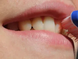 ładne zęby