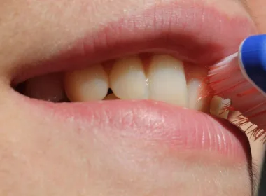 ładne zęby